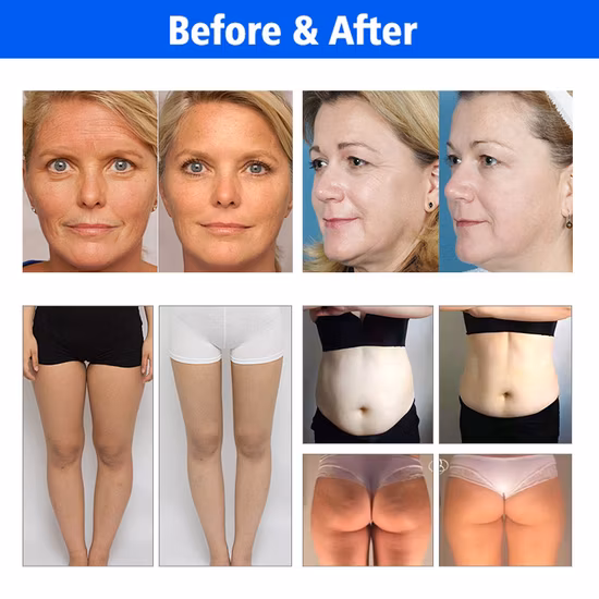 Máquina de emagrecimento de rolo de vácuo de RF infravermelho Sea Heart